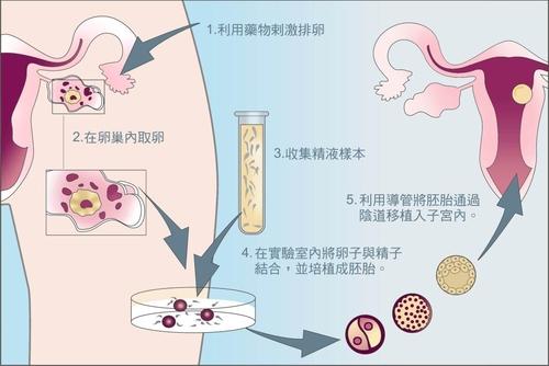 在开始试管婴儿周期之前，你是否已经充分了解了排卵情况？