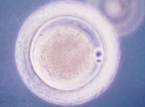 常州借卵试管助孕生殖中心：通过体外受精（IVF），囊胚不会排出体外，所以你不必担心过正常的生活。